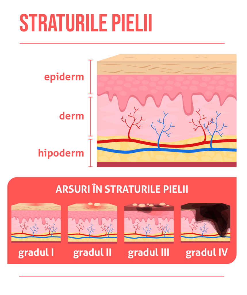 tipurile de arsuri